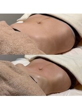 リ クリニカル ラボ(Re clinical Labo)/腸削り（腸マッサージ）
