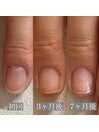 50代　形が悪い
