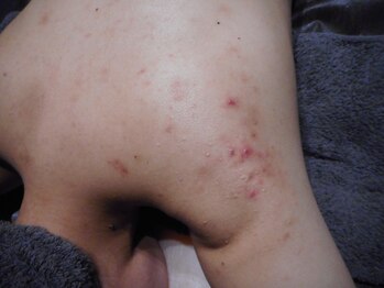 リシェラード/【背中美人】プレ花嫁さま　前