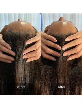 フフラ KANコルギセラピー山梨本店(fufla)/小顔ソムリエ【頭蓋骨】