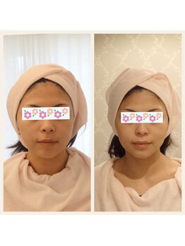 アンジェリカ(Angelica)/美バランスに！立体小顔に