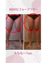 ルポーゼ(Repose)/