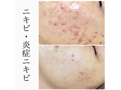 ビースキン 藤沢店(BeSkin)の写真