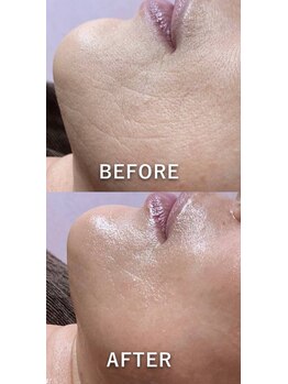 ココチ(KOKOCHI)/プレミアムインジェクション