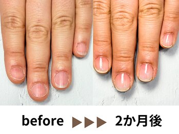 深爪自爪育成2か月の変化