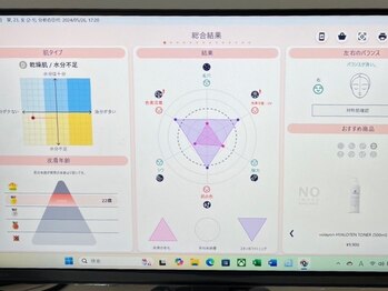 カルア(CALUA)の写真/AI肌診断で自分だけのお悩みに合わせた最適なアプローチをご提案♪最新のAI機能を搭載した精密肌診断機◎