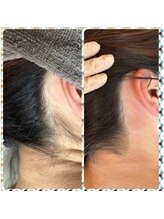 ヴェルマワックス 中目黒店(Velma Wax)/うなじワックス脱毛