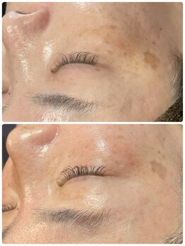 グランヴェルデ(GRAND VERDE)/素肌が自信に変わる。