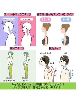 かえで鍼灸整体院/肩こりでお悩みの方