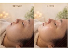 アネーロ(Anhelo)の雰囲気（身体やお顔の不調・コンディションを細かく聞き、ケアいたします）