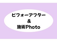 エヌフェイシャル(N.facial)/ビフォーアフター