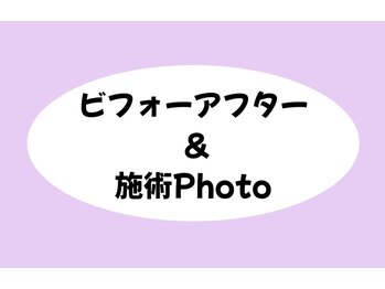 エヌフェイシャル(N.facial)/ビフォーアフター