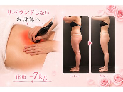 メディカルエステサロン ローズ 鯖江店(ROSE)の写真