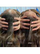 フフラ KANコルギセラピー山梨本店(fufla)/小顔ソムリエ【頭蓋骨】