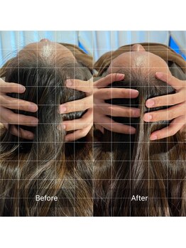 フフラ KANコルギセラピー山梨本店(fufla)/小顔ソムリエ【頭蓋骨】