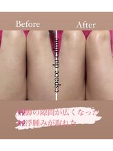 カルマーアンドビー(Calmer & Be.)/【レディース痩身】Before/After