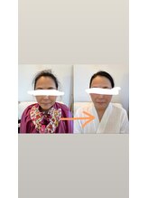 アルモワーズ(armoise)/