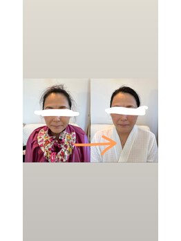 アルモワーズ(armoise)/