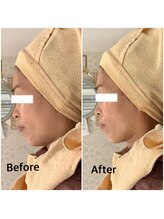 スペチアーレ 夙川/直後から驚きの引き上がり