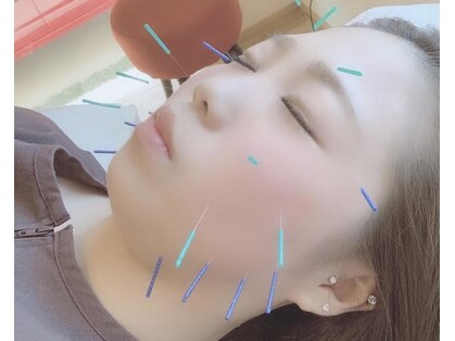 ハピネス(Happiness)の写真