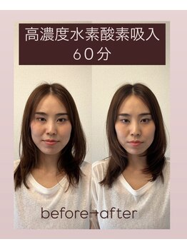 ヨサパーク リアン(YOSA PARK Lien)/モニター様before→after/痩身