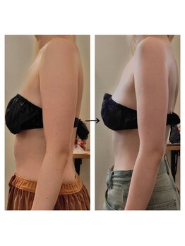 エステサロン カラーズ(COLORS)/ブライダル痩身6回