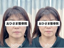 おひさま整骨院 整体院 姫路店/B＆A【姫路/小顔矯正/整体】