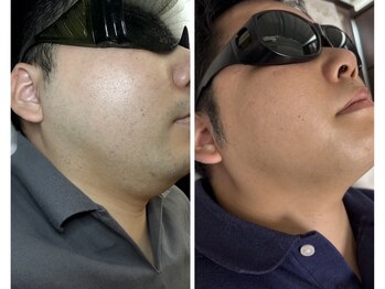 アプロディタ/清潔感ぐーんとUP！