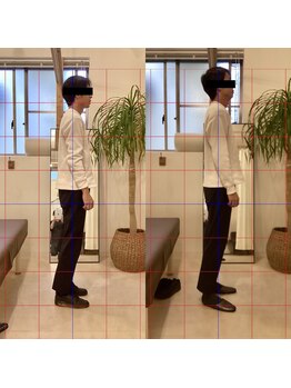 ドクターキュア 戸越店(DR.CURE)/姿勢改善整体ビフォーアフター