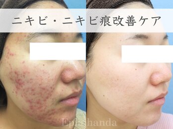 エピア 半田店(Epia)