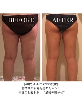 ヨサパーク フェリシア 西荻窪(YOSA PARK Felicia)/短期期間で集中ダイエット!