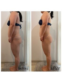 ドリームローズ(Dream Rose)/痩身