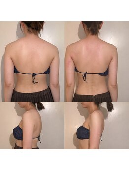 ソバニ(SOBANI)/巻き肩・肩こり改善