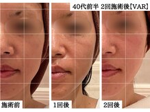 ギノーアンスティテュ パリ 六本木ヒルズ店(GUINOT INSTITUT PARIS)の雰囲気（たった30分で効果を表す大人気！【ヴィジブル エイジ リバース】）