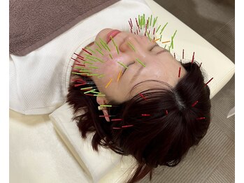 まごころ整骨院の写真/【SNSで話題◎】美容鍼で深部に直接アプローチ!ハリネズミ美容鍼で肌改善!美容液の浸透率もUP★