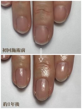 ラピスネイル(Lapis Nail)/爪の健康を考えるコース