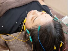 【女性専用完全個室】ひまわり鍼灸治療院 肩こり/腰痛/姿勢改善/美容鍼の雰囲気(美容鍼は美容面だけでなく、体調もスッキリ整う!と人気のコース)