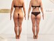 サロン ド モナ(salon de mona)の写真/【下半身セルライトケア】30代からの本気の美脚集中プログラム！浮腫み、セルライトケアで美脚づくり★