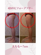 ルポーゼ(Repose)/