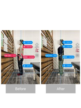 ナオル整体 大塚院(NAORU整体)/30代女性施術事例【姿勢矯正】