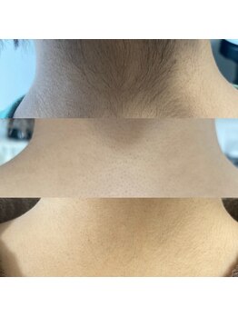 プライベートサロン結/襟足シェービング