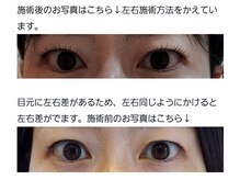 アロマスイーツ(AromaSweets)/まつげパーマ・まつ毛パーマ