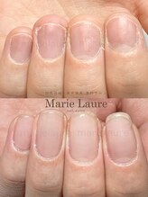マリーロール 梅田店(Marie Laure)/深爪改善/自爪育成/ネイルケア