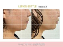 アメリイ 百合ヶ丘 新百合ヶ丘(Amerii)/【レモンボトル】1回の結果