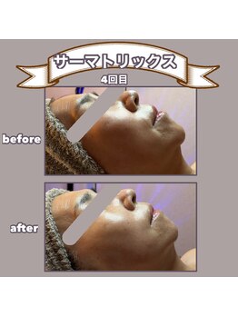 ビーマジック(美magic)/