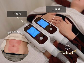 リュール横浜(LUEUR)の写真/【結果重視！】脂肪冷却 全身８カップ美しいカラダ作り★結婚式ブライダルエステにも当店大人気！