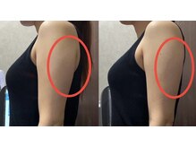 オンフリーク(ON FLEEK)/女性人気★ぷよぷよ二の腕撃退