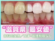 ホワイトニングショップ 甲賀店