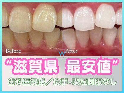 ホワイトニングショップ 甲賀店の写真