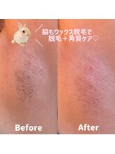 ココカナ(COCOKANA)/脇もワックス脱毛で黒ずみ改善◎